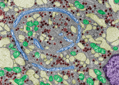 False colour electron microscope micrograph showing the Golgi apparatus (blue), mitochondria (green), very dilated RER cisterns (pale yellow) and secretory granules (dark red) in a gonadotropic cell.\
