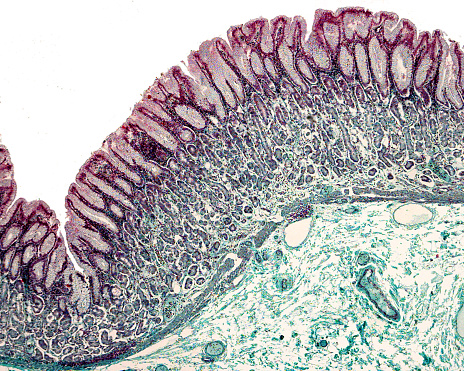 Gastric mucosa stained with the Masson trichrome stain showing: surface epithelium, gastric pits with foveolar cells, fundic glands and muscularis mucosae.