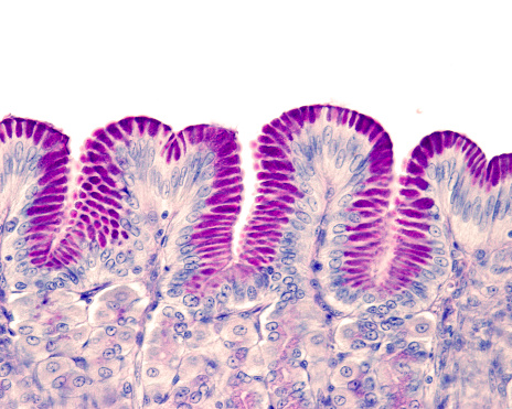 Gastric mucosa stained with the Periodic Acid Schiff (PAS) technique showing the intense PAS positivity of the surface epithelium and the foveolar cells of gastric pits.