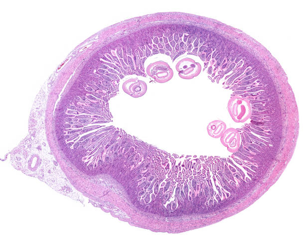 istock Small intestine. Pinworm infection 1292384864