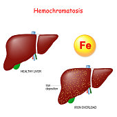 h%C3%A4mochromatose-oder-eisen%C3%BCberl