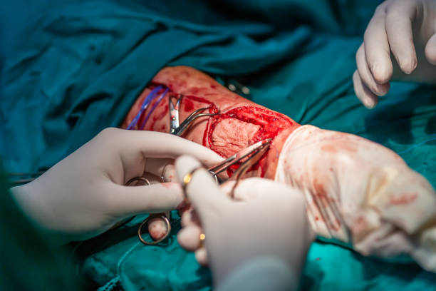 chirurgia del lembo libero dell'avambraccio radiale - close cut foto e immagini stock
