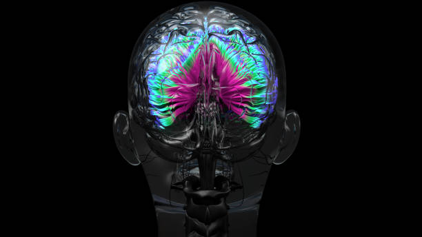 mänsklig hjärna, neurones anslutningar. färgglada hjärnan mri scan - brain scan' bildbanksfoton och bilder
