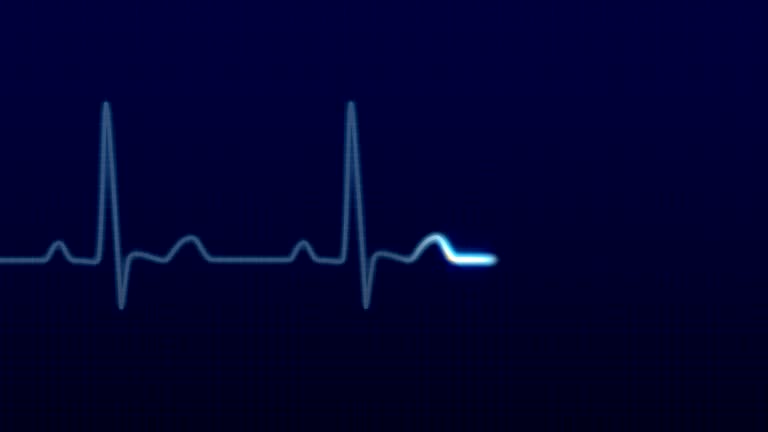 Free Ekg Stock Video Footage 138 Free Downloads Free Ekg Stock Video Footage 138 Free Downloads