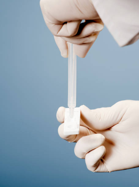 Doctor holding a test kit for viral disease tests with the COVID-19 SARS-CoV-2 laboratory card kit for the novel viral coronavirus sars cov 2 virus (formerly known as 2019-nCov) científico de laboratorio que realiza pruebas de diagnóstico rápido de rdt para anticuerpos para detectar la presencia de proteínas virales (antígenos) expresada por la enfermedad por virus corona covid-19, prueba rápida de detección de anticuerpos
