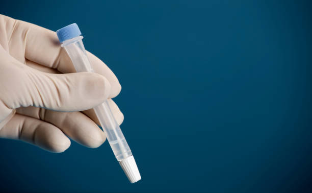 istock Laboratory scientist with vial and swab indoors performing a rapid diagnostic test, for antibodies, detecting the presence of viral proteins (antigens) expressed by corona virus disease COVID-19, rapi 1293077396