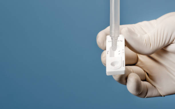 Doctor holding a test kit for viral disease tests with the COVID-19 SARS-CoV-2 laboratory card kit for the novel viral coronavirus sars cov 2 virus (formerly known as 2019-nCov) científico de laboratorio que realiza pruebas de diagnóstico rápido de rdt para anticuerpos para detectar la presencia de proteínas virales (antígenos) expresada por la enfermedad por virus corona covid-19, prueba rápida de detección de anticuerpos