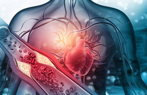 menschliches herz mit verstopften arterien - herz kreislauf stock-fotos und bilder