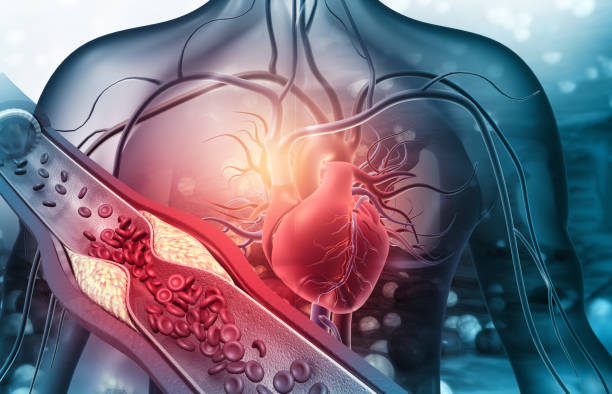 menschliches herz mit verstopften arterien - krankheit stock-fotos und bilder