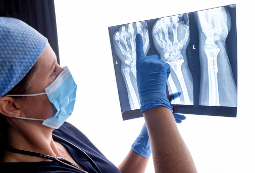 Orthopedic surgeon studying a x-ray of a broken radius bone in theater after correctional surgery.