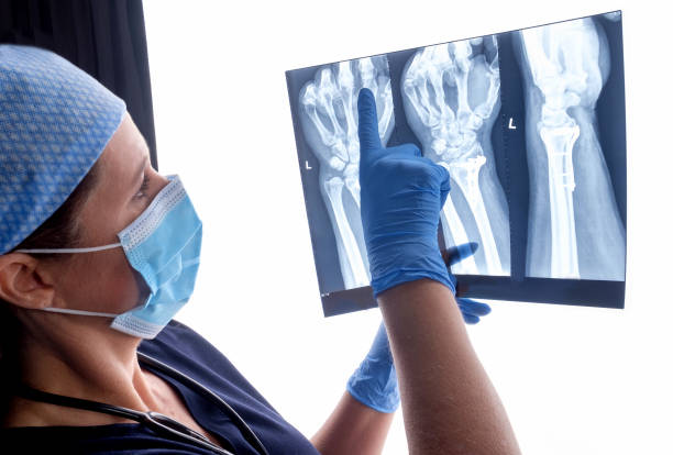 Orthopedic surgeon looking at X-Rays after surgery procedure has been completed Orthopedic surgeon studying a x-ray of a broken radius bone in theater after correctional surgery. fracture stock pictures, royalty-free photos & images