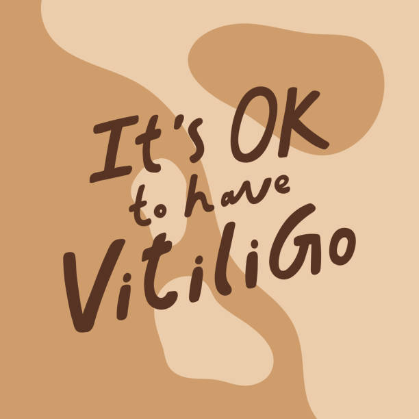 it is OK to have Vitiligo. Hand drawn calligraphic lettering poster. it is OK to have Vitiligo. Hand drawn calligraphic lettering poster. Vector illustration vitiligo stock illustrations