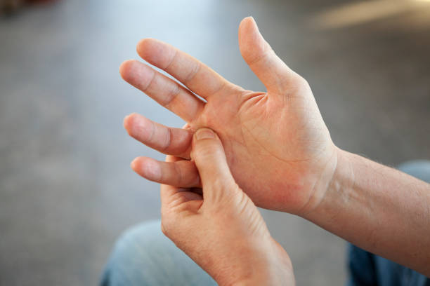istock Man massaging own hand with pain 1293418744