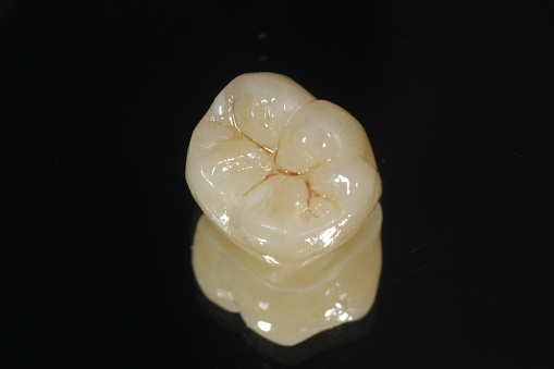 Full ceramic crown of a molar.
