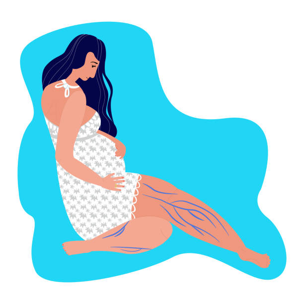 Concept treatment of varicose veins during pregnancy Vector flat illustration young pregnant woman who has varicose veins on her legs. Concept treatment of varicose veins during pregnancy, vascular surgery, phlebology, compression stockings. human vein stock illustrations