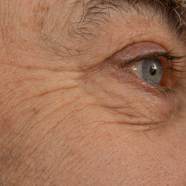 arrugas en la cara de un hombre alrededor de los ojos - pain human eye senior adult men fotografías e imágenes de stock