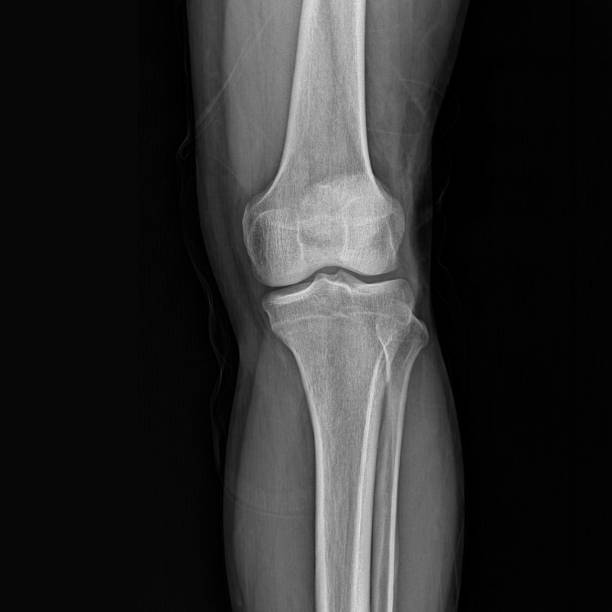 istock Sporting injury stock photo 1293533892