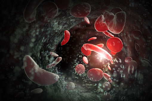 Sickle cell anemia disease (SCD) blood cells 3D illustration