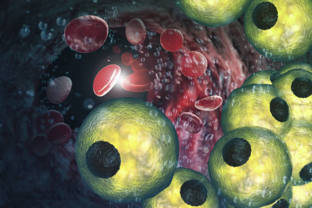 istock Adipocyte Fat Plaque Artery 3D Illustration 1293658748