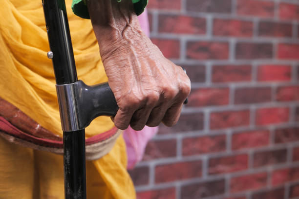 istock senior women with broken leg on crutches. 1293822873