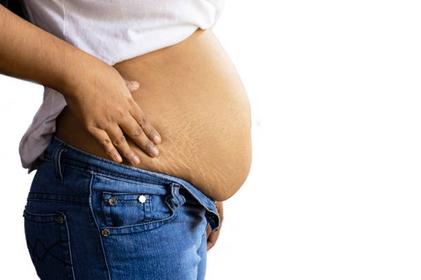 istock belly fat - woman 1293967077