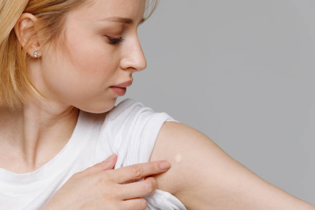 istock Woman looks at birthmark on her hand 1294344846