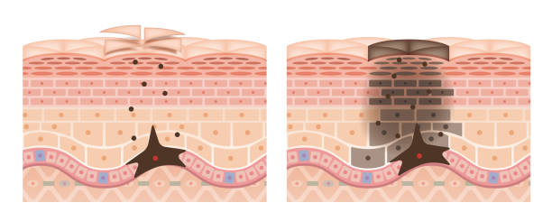 Cross section of the skin 2 front No commentary Cross section of the skin 2 front No commentary freckle stock illustrations