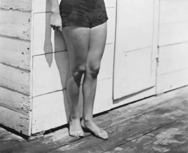 Young Woman Wearing Swimwear in 1935.