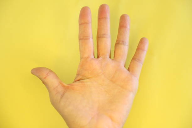 istock Hand on the yellow background 1294430061