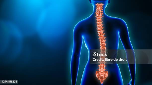 Curvature Of The Spine And Woman Body Back View 3d Rendering Illustration With Copy Space Spine Disorder Scoliosis Backbone Injury Human Anatomy And Medical Concepts Stock Photo - Download Image Now