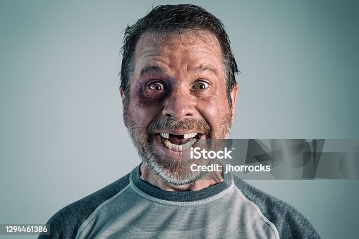 452 Funny Toothless Man Stock Photos, Pictures & Royalty-Free Images -  iStock