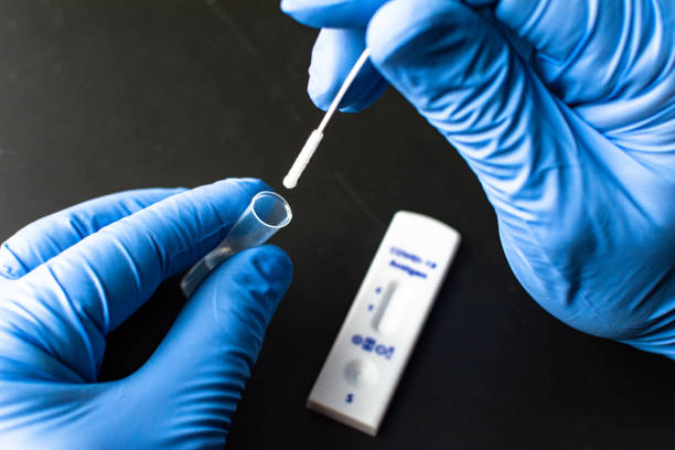 Corona Quick Test Chopsticks Corona Rapid Antigen Test antigen photos stock pictures, royalty-free photos & images