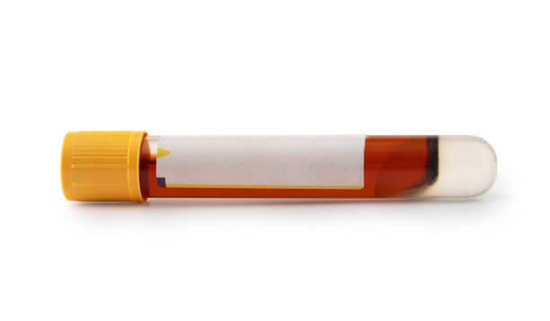 istock Test tube with blood isolated on white background 1294605396
