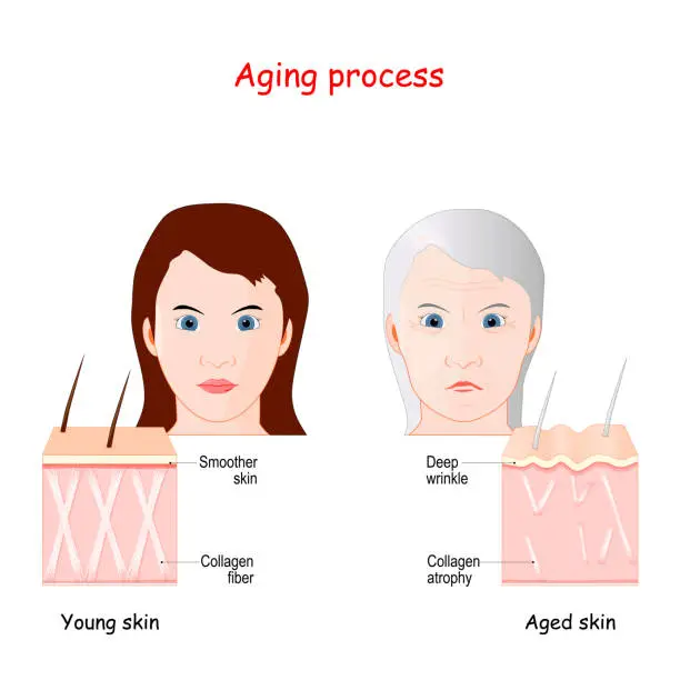 Vector illustration of skin Aging process.