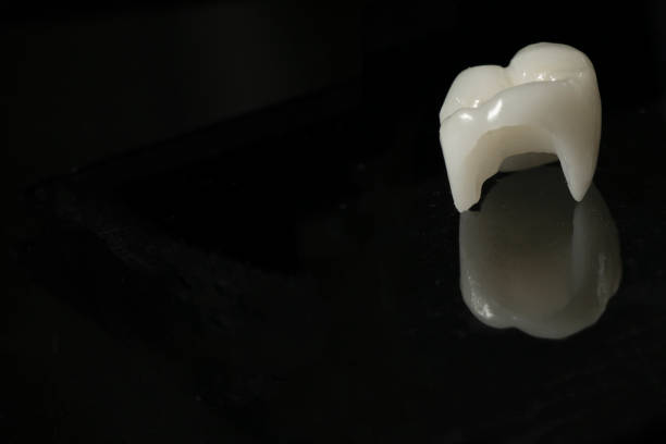 istock ceramic crown for dental treatment 1294679254