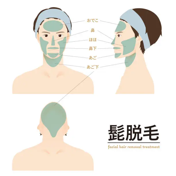 Vector illustration of Laser hair removal male 1