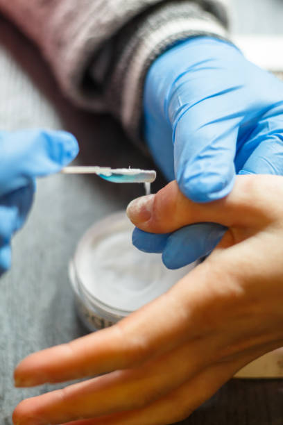 istock young woman doing a manicure after panaritium treatment 1295072672