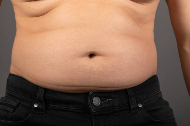 istock Bloated stomach close up 1295179042