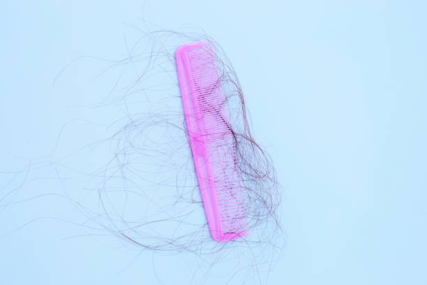 istock Hairs loss fall in comb on white background. 1295241175