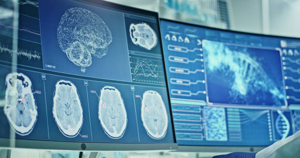 istock Laboratory equipment, microscope and computers. Brainwave research on screens. Side view of scientist 1295324810