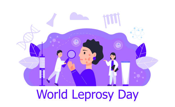World Leprosy Day is observed on the last Sunday in January. Doctors treat ill patient. Medical concept vector for flyer, post, banner, blog World Leprosy Day is observed on the last Sunday in January. Doctors treat ill patient. Medical concept vector for flyer, post, banner, blog, web. leprosy stock illustrations