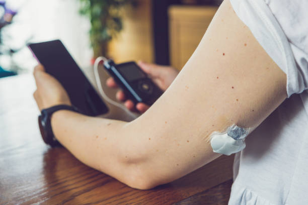 tratamiento moderno de la diabetes, mujer comprobando el nivel de glucosa y la insulina dosificadora usando la bomba de insulina y el sensor remoto en su mano, se centran en el primer plano - ordenador para utilizar como accesorio fotografías e imágenes de stock