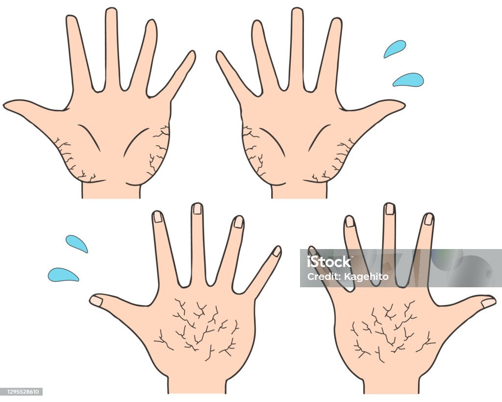 Hand Cracking Drawing Reference Hand Cracks Stock Illustration - Download Image Now - Alternative ...