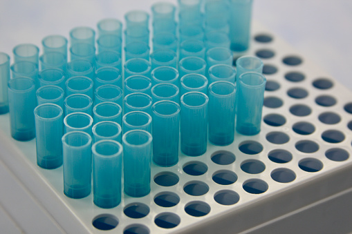 Blue pipette tips in a gray rack in a laboratory