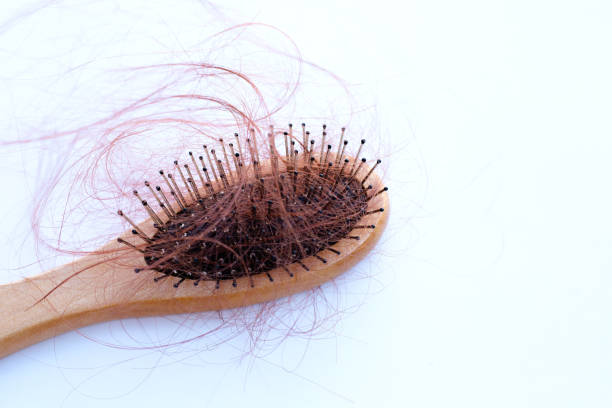 istock Hairs loss fall in comb on white background. 1295728282