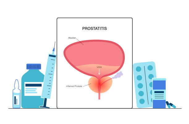 Prostate Problems Graphics 200+ Enlarged Prostate Stock Illustrations, Royalty-Free Vector ...