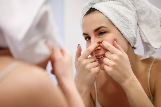 istock Woman squeeze pimple on cheek after shower 1295917945