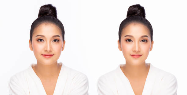 istock Compare faces before and after when beauty woman get Cosmetic surgery and Plastic surgery Asian girl has V shape face and has beautiful facial skin Plastic Surgery Cosmetic surgery concept 1295921155