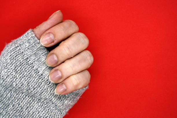 istock Female hand with bitten nails on a red background. 1295953706