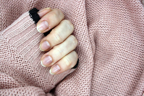 istock Female hand with bitten nails on a pink background. 1295953739